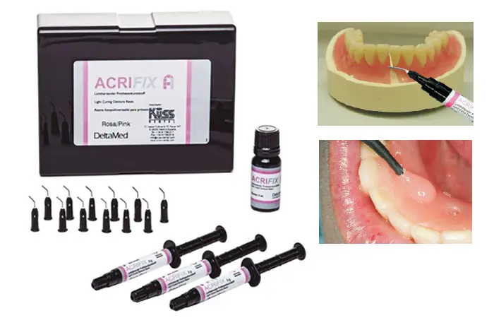 ACRIFIX - KUSS