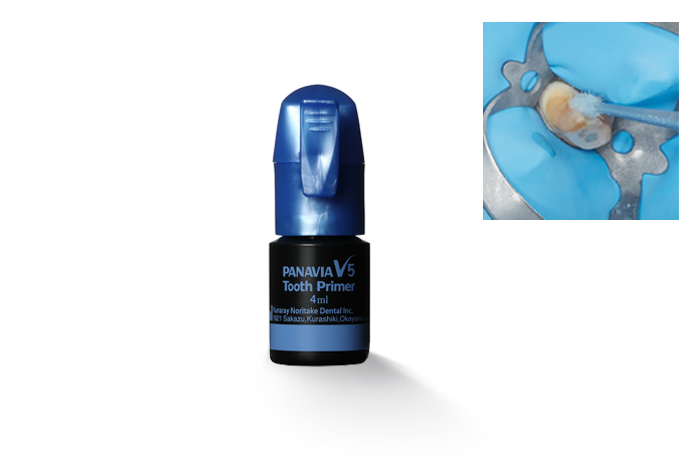 PANAVIA V5 TOOTH PRIMER - KURARAY NORITAKE