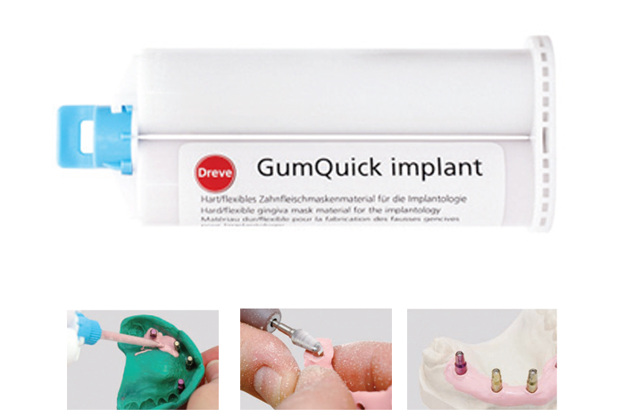 GUMQUICK IMPLANT - DREVE